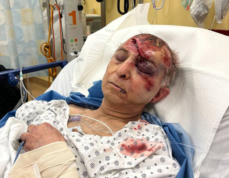 79-year-old jeweler beaten to coma by bandits who stole $100,000 worth of jewelry