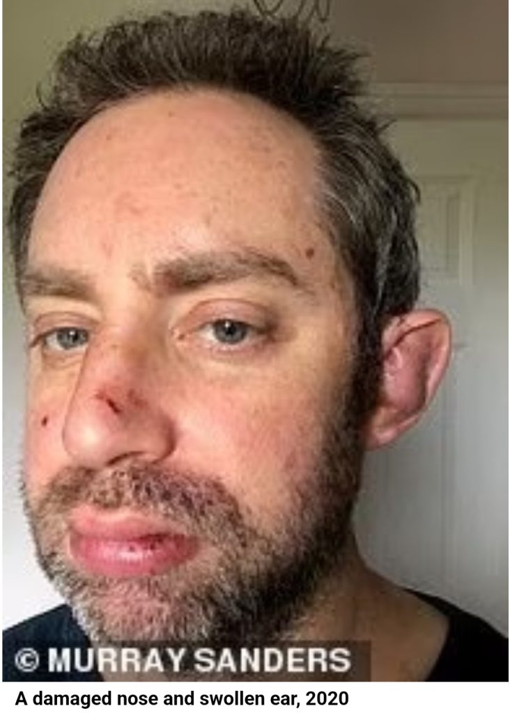 "I wore make-up to hide bruises my wife gave me" Man opens up about the years of abuse he suffered in his marriage